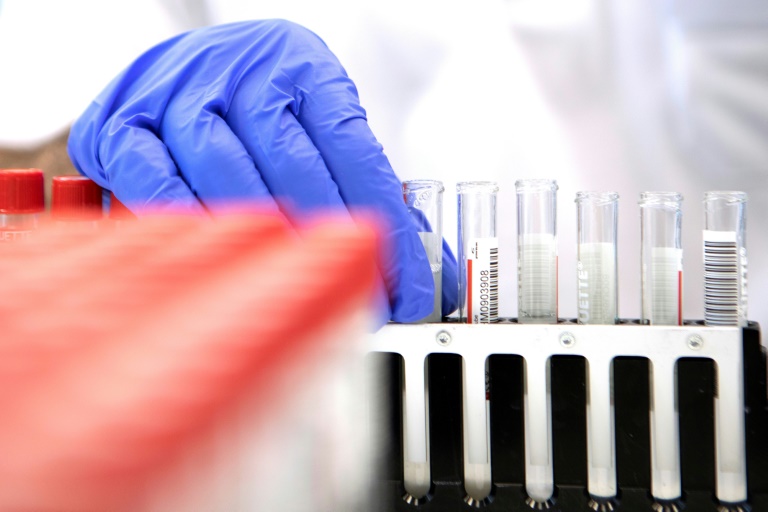 Chinese scientists say new highly accurate virus test gives results within minutes » Capital News