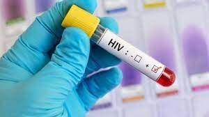 sample of HIV infected blood
