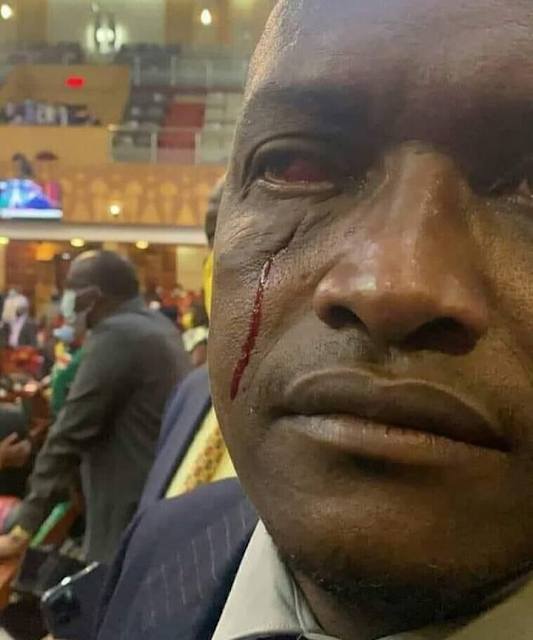 Sigowet Soin MP Benard Koros photo while injured Sigowet Soin MP Benard Koros photo while injured
