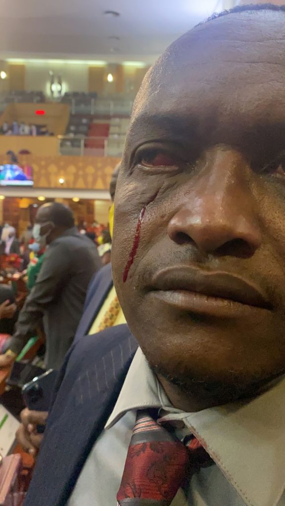 MP seriously injured during National Assembly chaos pitting Tanga Tanga and Kieleweke » Capital News