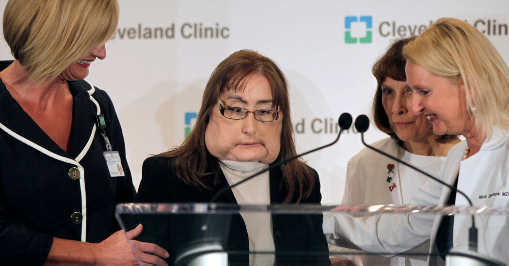 Connie Culp, First Face Transplant Recipient in U.S., Dies at 57
