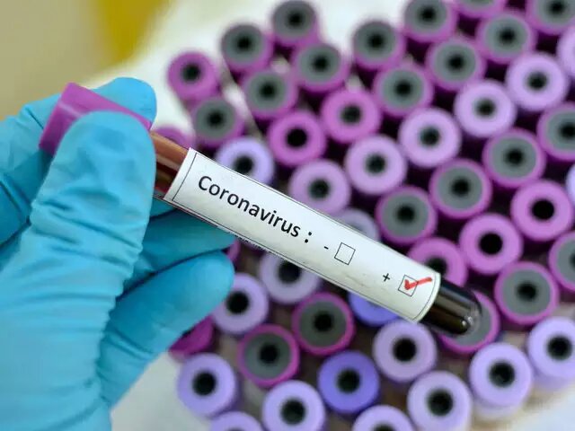 Get paid Sh. 469,000 to get coronavirus!