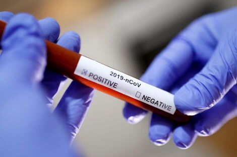 City Hospital Closed Over 'Fake Covid-19 Tests' [VIDEO]