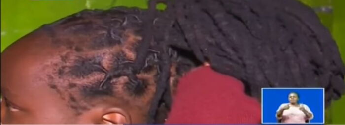 Form One Student Chased Away Over Dreadlocks