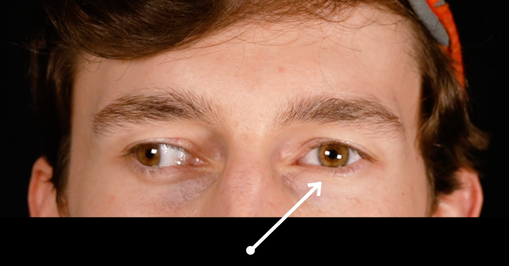 Opinion | I'm Visually Disabled, And I Want to Show You How Life Looks Through My Eyes