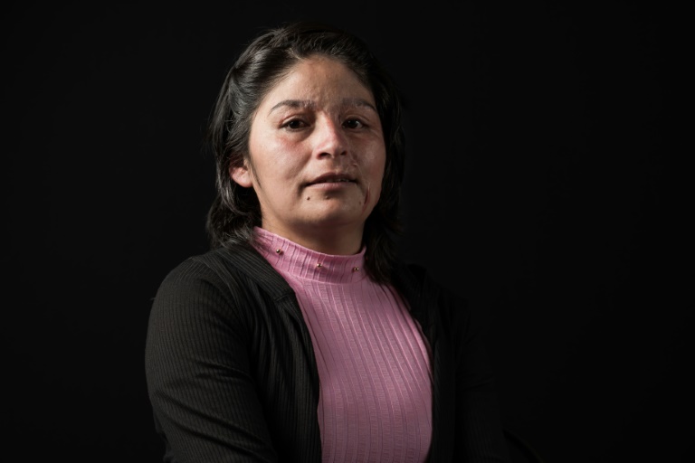 Mexico's acid attack victims » Capital News