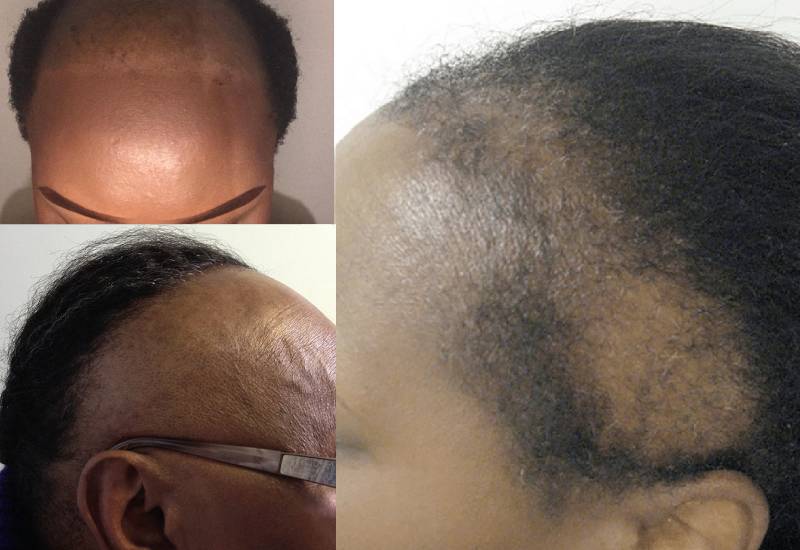 Finally, you can say goodbye to baldness Eve woman