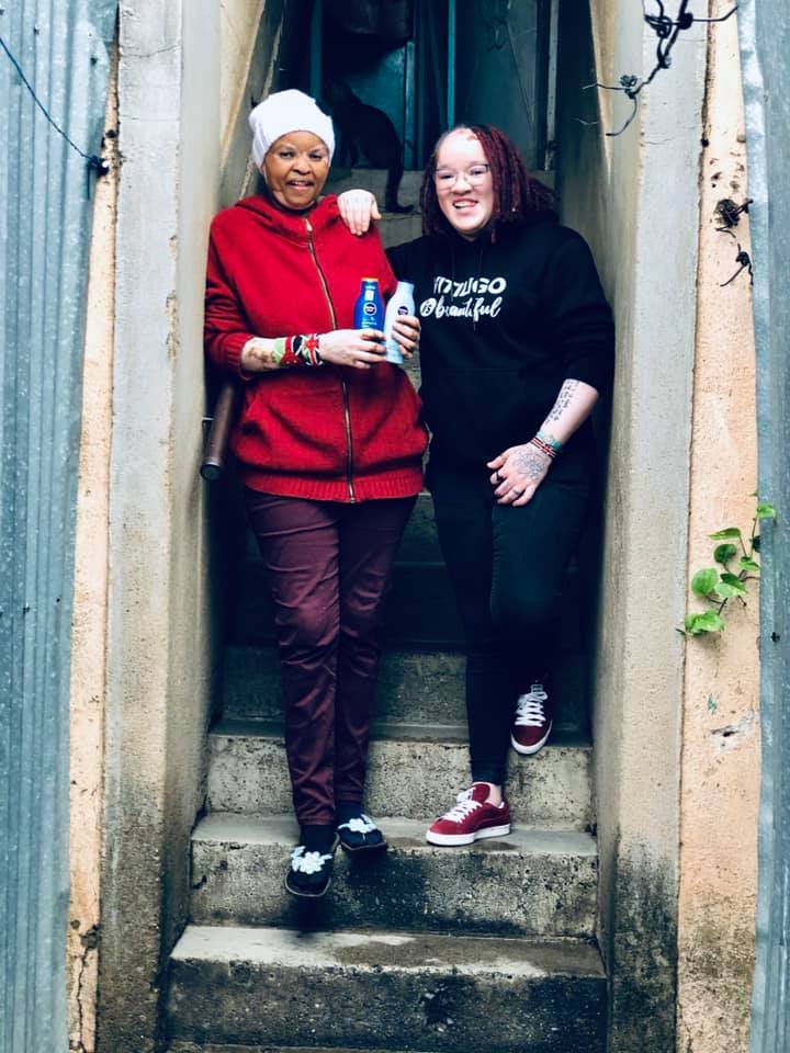 Ex-Machachari actress Mama Stella receives help to manage her vitiligo skin condition