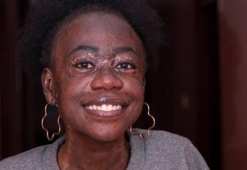 Rare illness overwhelmed me, I attempted suicide Eve woman
