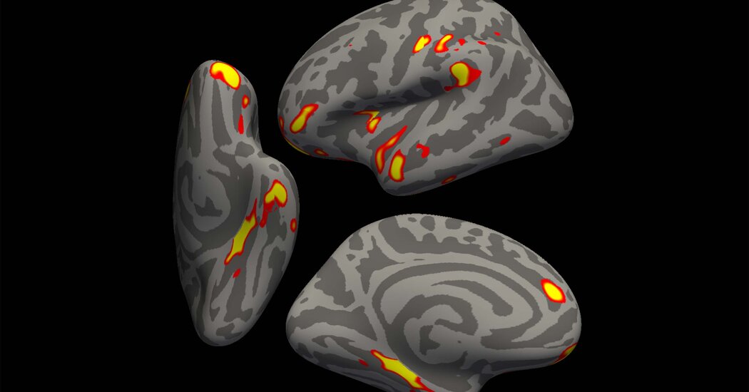 Covid May Cause Changes in the Brain, New Study Finds