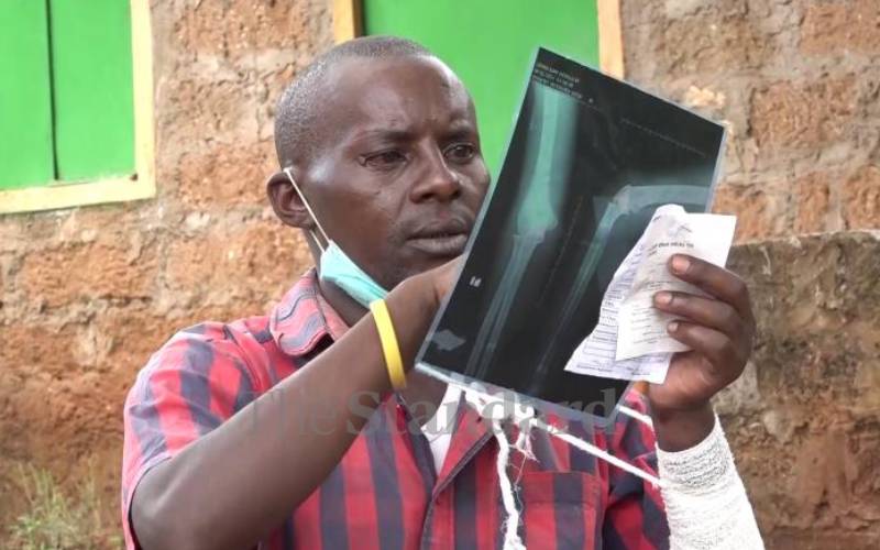 Rights group decries police brutality in Embu