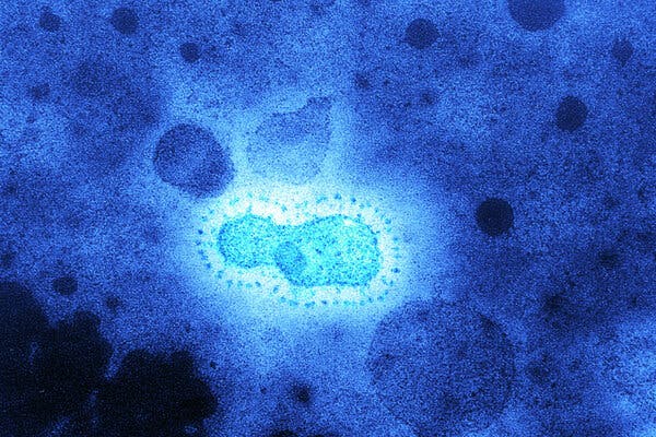 A colored transmission electron micrograph of a type of coronavirus.