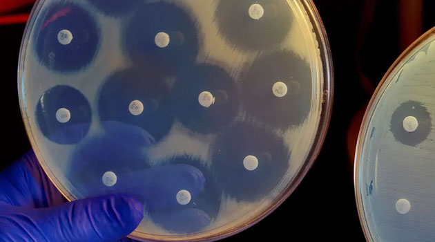 Antibacterial resistance overtakes HIV, Malaria to become leading cause of deaths » Capital News