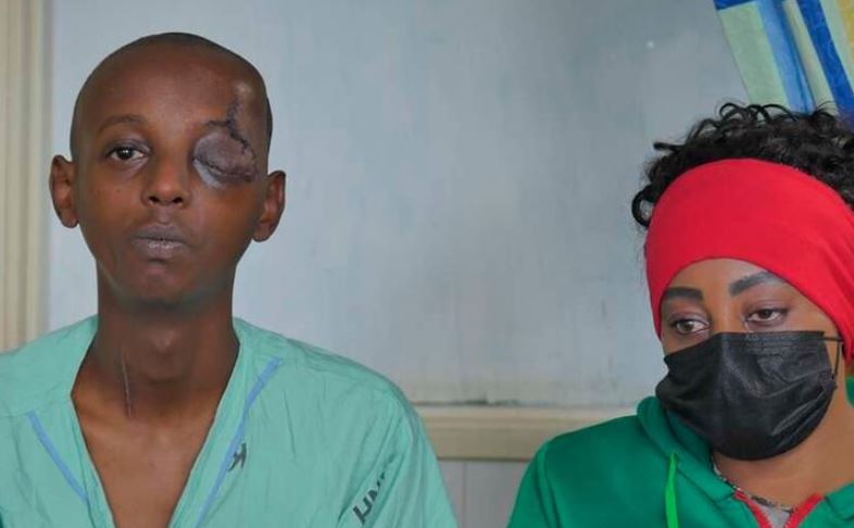 KNH Surgeons Save Teenager with Knife Stuck in Brain Through Eye