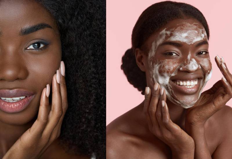 How to get rid of hyperpigmentation on dark skin Eve woman