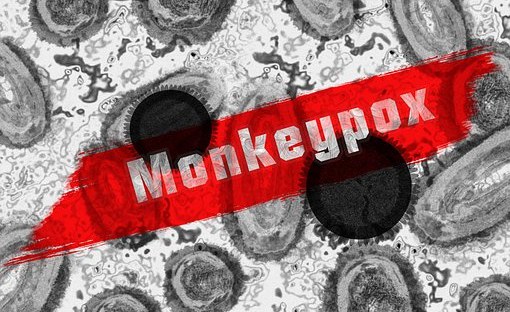 Kenya: Health Ministry Says No Case of Monkeypox in the Country