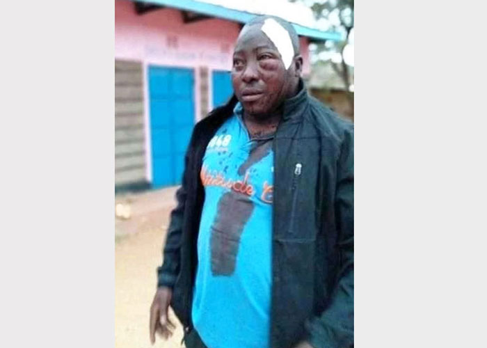Students beat up teacher who asked them to stop eating from sufurias