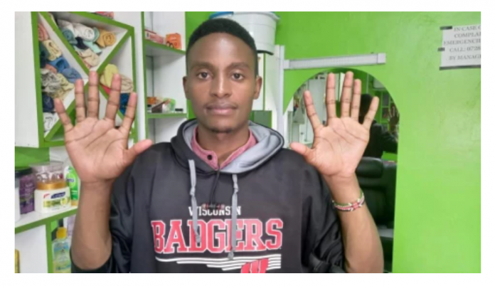 Man With Six Fingers Turns Into a Massage Celebrity