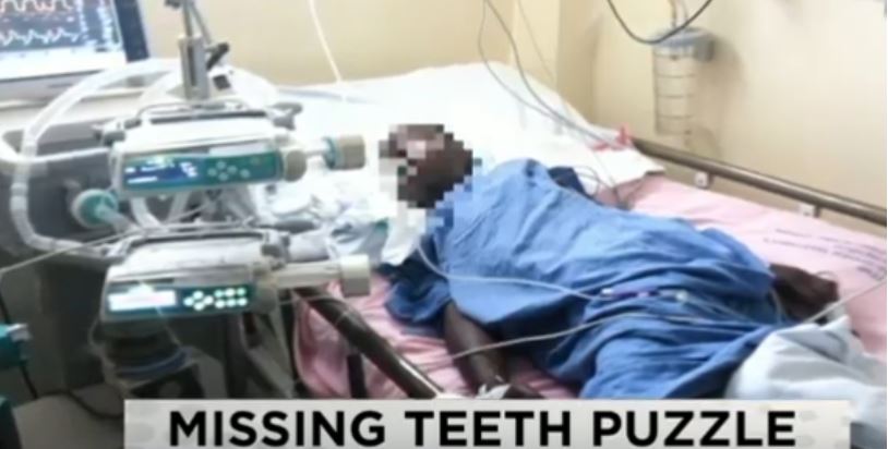 Mother's Agony after Daughter, 11, Loses Teeth following Botched Eye Surgery