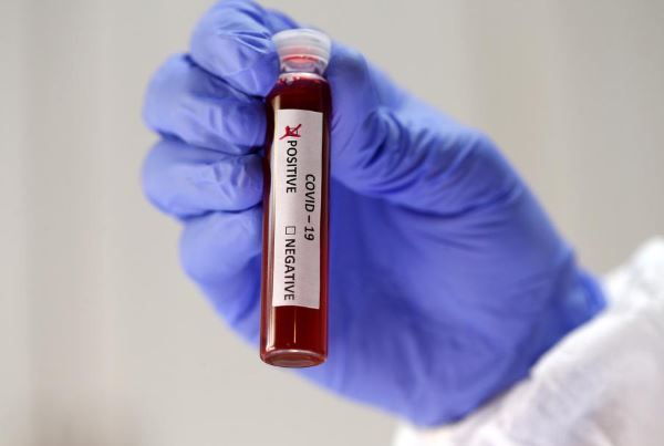 What you need to know about the coronavirus right now : The standard Sports