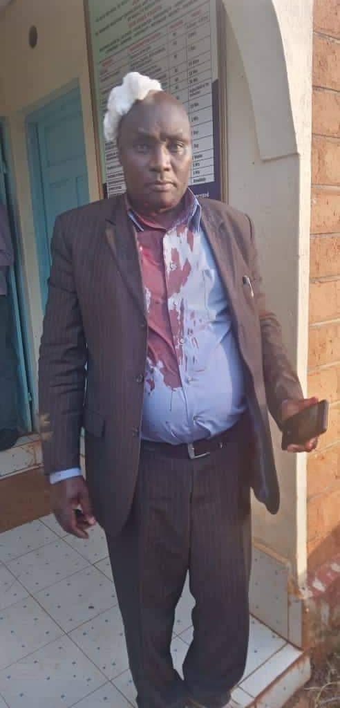 Form 3 Student At Ainamoi On The Run After Driving 4-Inch Nail Into Principal`s Head