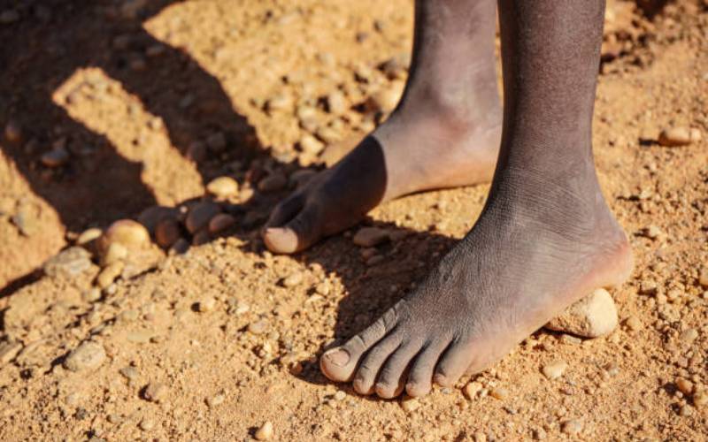Pastor burns feet of three teens over theft of Sh80 cake