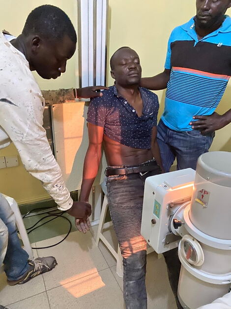 The contractor who was allegedly beaten up by Mathare MP Anthony Oluoch's bodyguards on January 13, 2022.