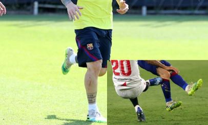 Deep scars spotted on Messi’s leg following horror tackle at Sevilla [PHOTOS]
