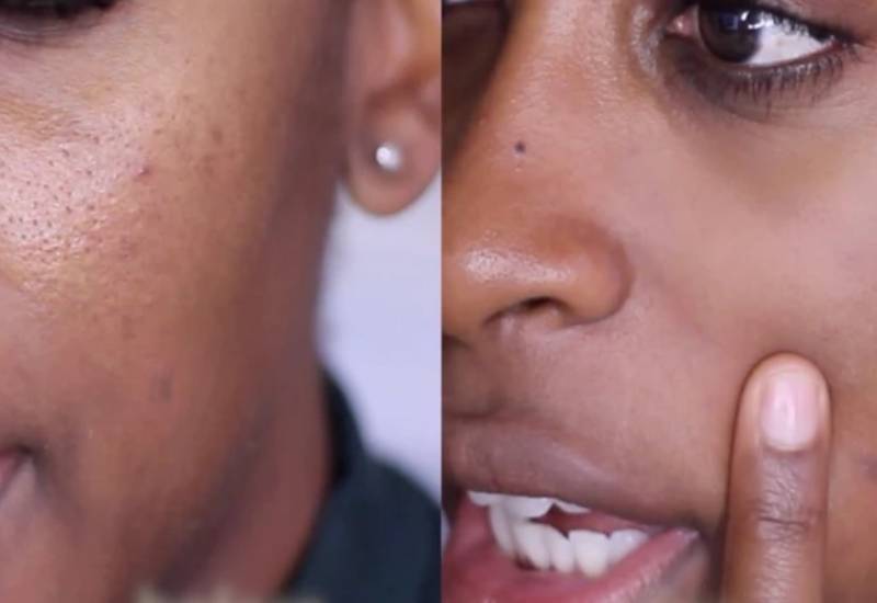 How to get rid of enlarged pores Eve woman
