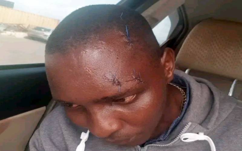 Asbel Kiprop denies sustaining head injuries in nightclub fight