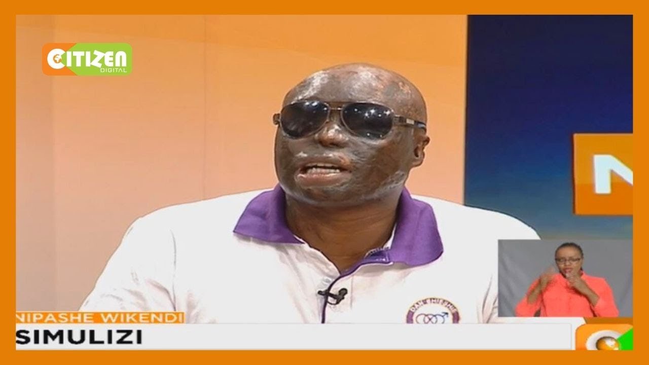 | SIMULIZI | Dan Matakayia asimulia alivyomwagiwa asidi na mkewe