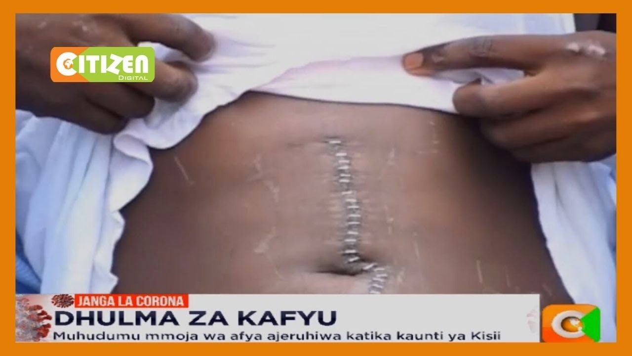 Polisi walaumiwa kwa kukiuka haki za kibinaadam wakati huu