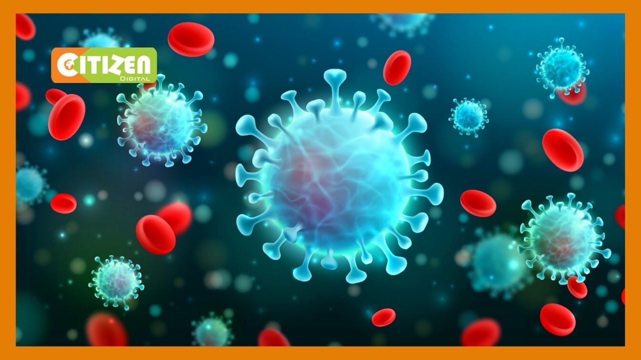 MONDAY REPORT TOWNHALL | Government calls for local solutions for COVID-19 pandemic
