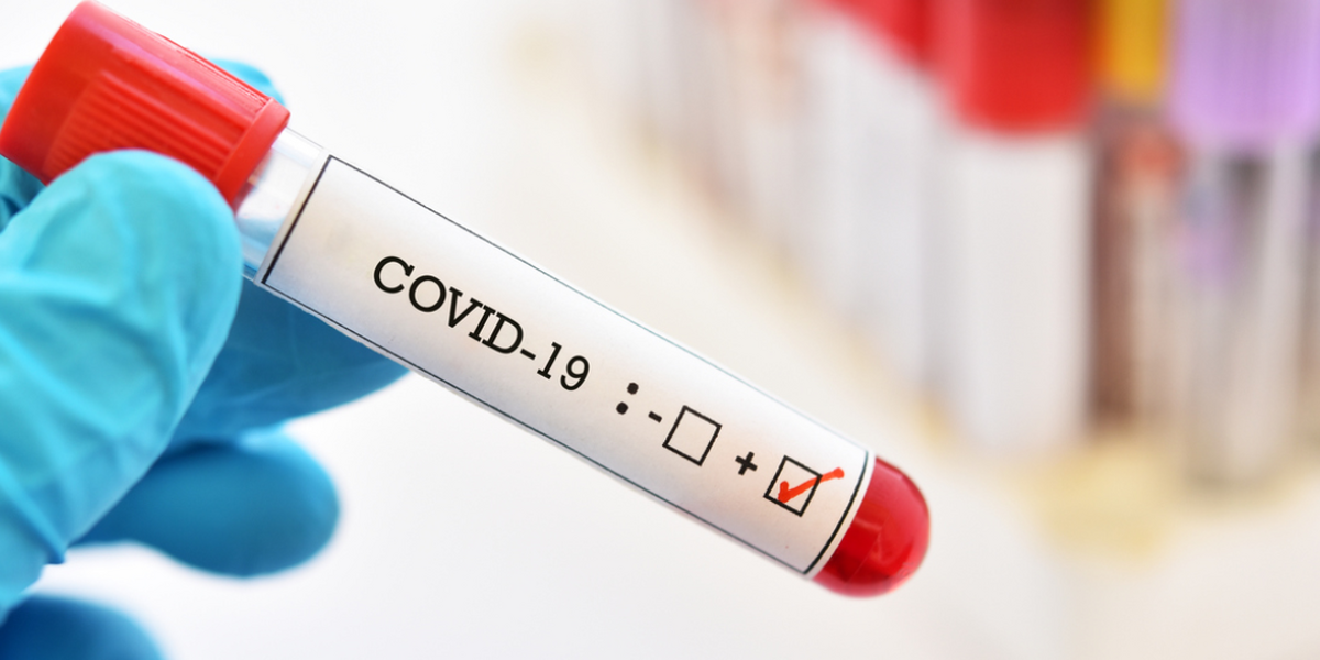 Positivity rate at 8% as 188 more test positive for Covid-19 in Kenya - Health CS Mutahi Kagwe
