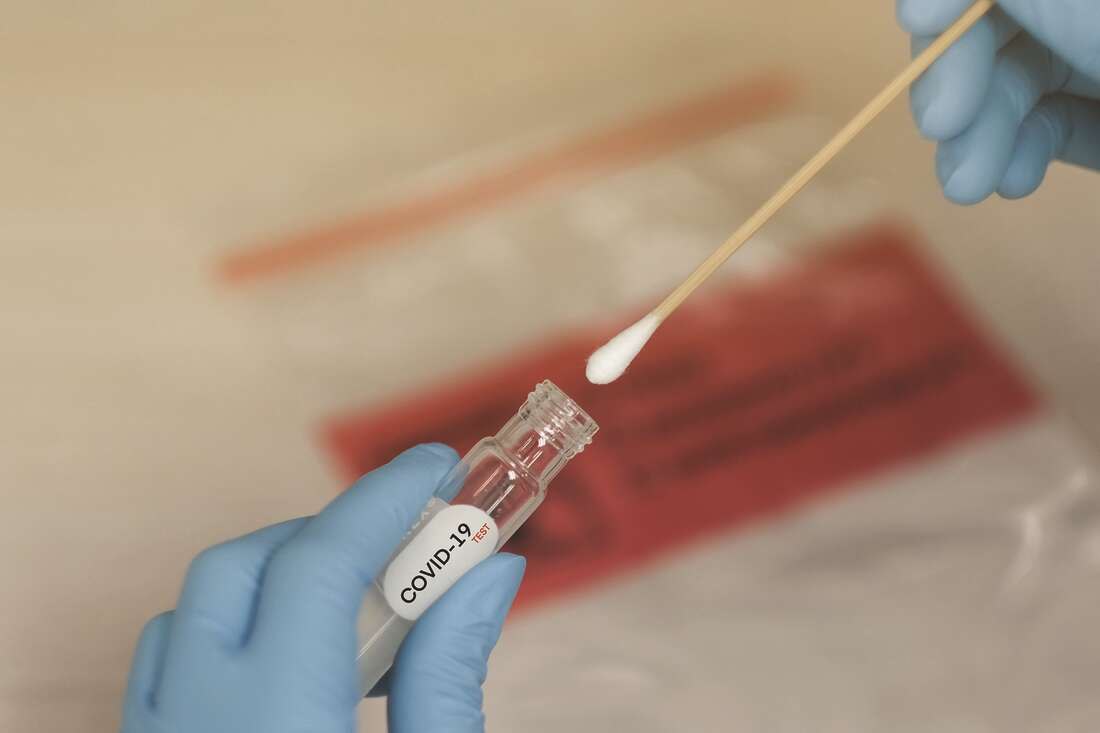 Covid-19 Positivity Rate Rises to 6.5 PC as 149 Test Positive