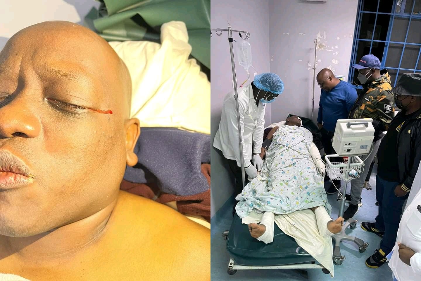 Dennis Itumbi Moved to ICU as His Health Politicised Severely