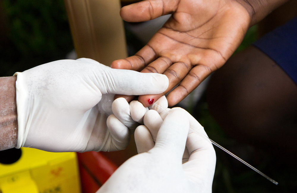 Kisumu-Tested Drug to Prevent HIV Approved in the Us