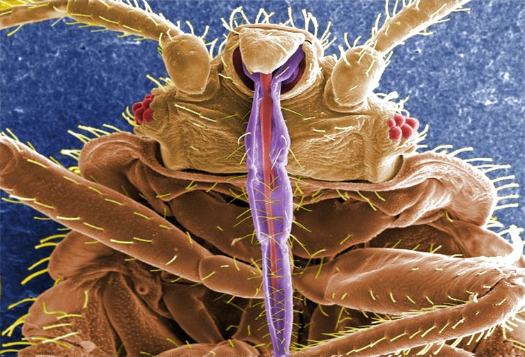 Bed bugs’ biggest impact may be on mental health after an infestation of these bloodsucking parasites